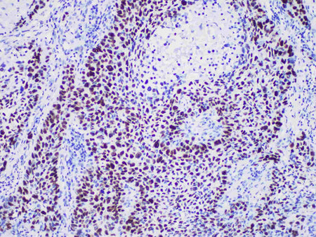 p40 Monoclonal Antibody Stored at -20°C