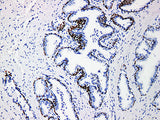 p63 Monoclonal Antibody Stored at 2~8°C