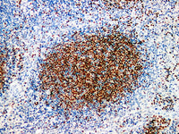 Pax-5 Monoclonal Antibody Stored at -20°C