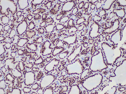 Pax-8 Monoclonal Antibody Stored at -20°C