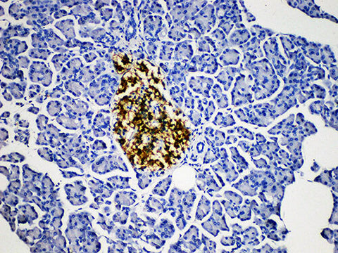 PGP 9.5 Monoclonal Antibody Stored at -20°C