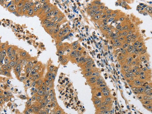 PIK3R3 Polyclonal Antibody Store at -20°C