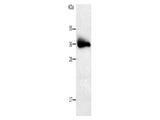PLPP1 Polyclonal Antibody Store at -20°C, Biomarkers, Elabscience Biotechnology, MSE Supplies