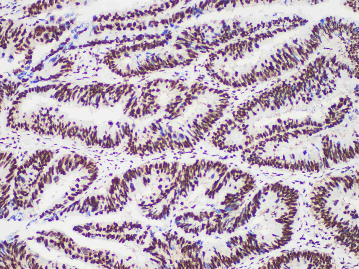 PMS2 Monoclonal Antibody Stored at 2~8°C