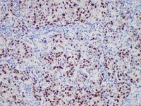 PR Monoclonal Antibody Stored at 2~8°C