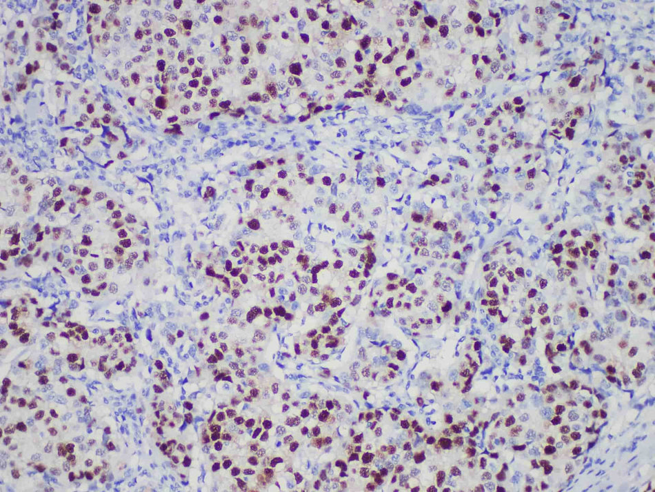 PR Monoclonal Antibody Stored at -20°C