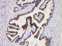 PSAP Monoclonal Antibody Stored at -20°C