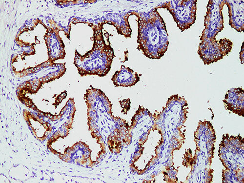 PSMA Monoclonal Antibody Stored at 2~8°C
