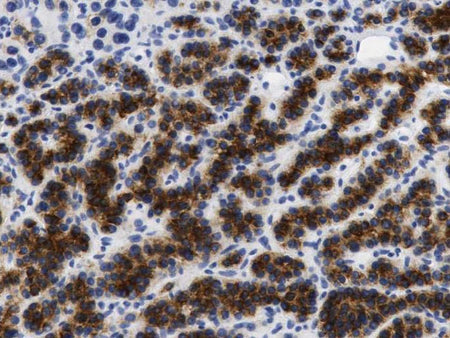 PTH Monoclonal Antibody Stored at 2~8°C