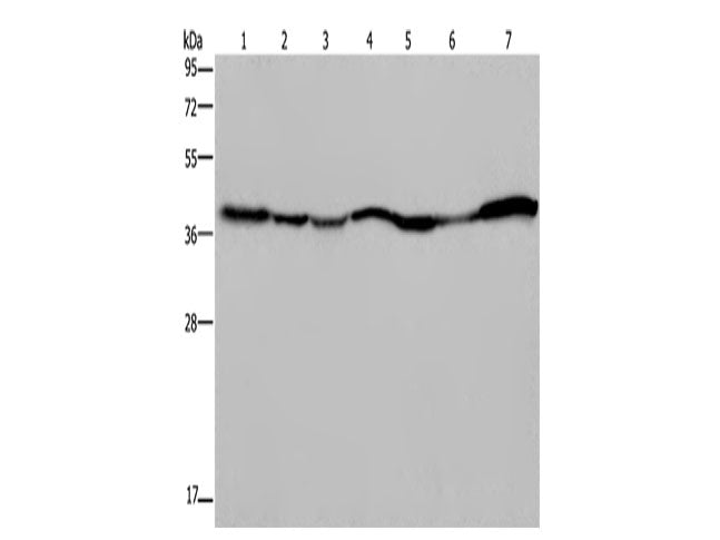 GOT2 Polyclonal Antibody Store at -20°C