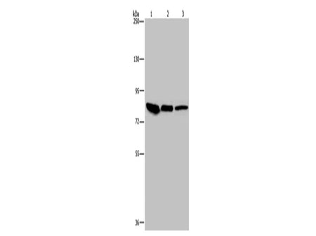 Catenin gamma Polyclonal Antibody Store at -20°C