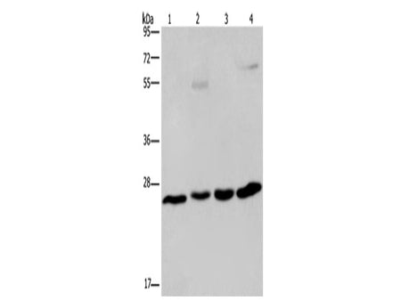 ETHE1 Polyclonal Antibody Store at -20°C