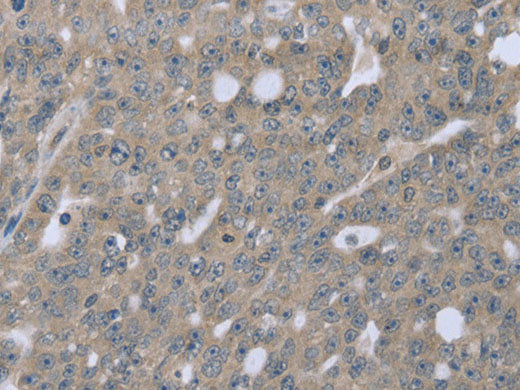 BMX Polyclonal Antibody Store at -20°C