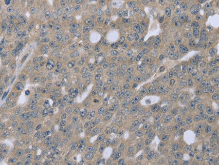 BMX Polyclonal Antibody Store at -20°C