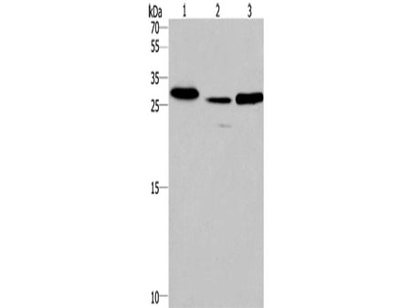 IRAK1BP1 Polyclonal Antibody Store at -20°C