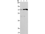 ALS2CR11 Polyclonal Antibody Store at -20°C