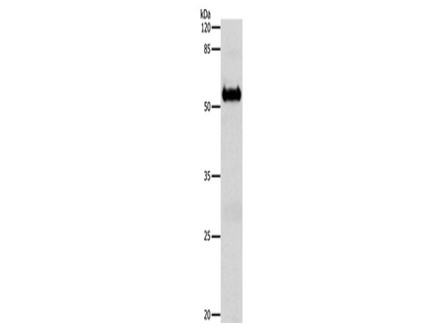 SLC1A6 Polyclonal Antibody Store at -20°C
