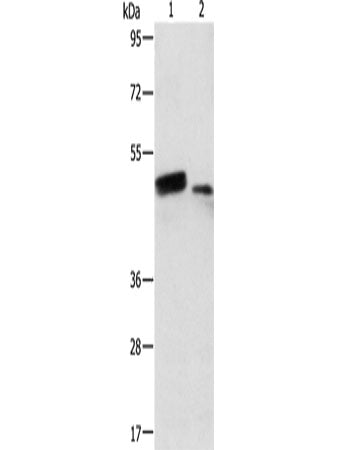 RARB Polyclonal Antibody Store at -20°C