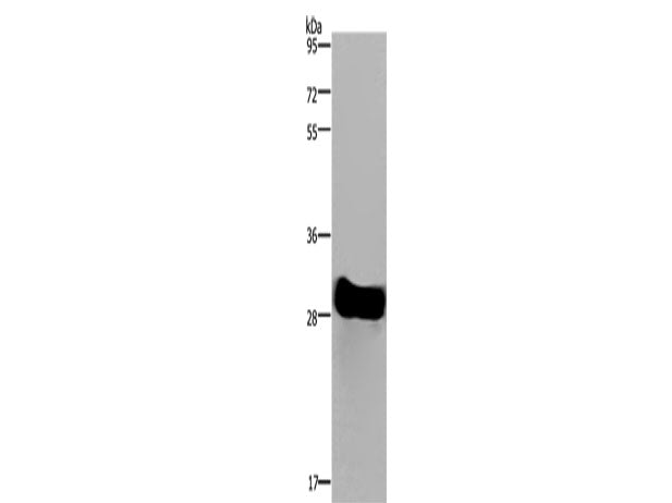 FHL2 Polyclonal Antibody Store at -20°C