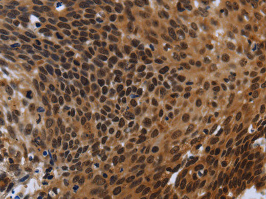 FHL3 Polyclonal Antibody Store at -20°C