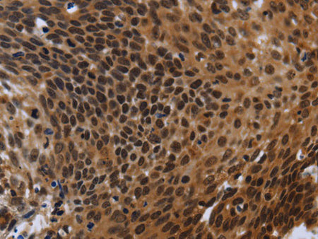 FHL3 Polyclonal Antibody Store at -20°C