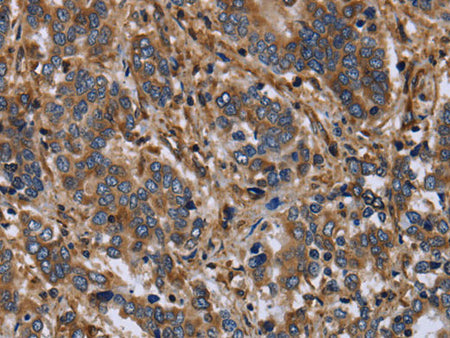 FLNA Polyclonal Antibody Store at -20°C