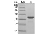 Recombinant 2019-nCoV 3C-like Proteinase Protein (His Tag)