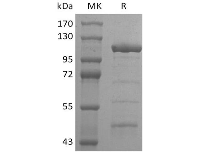 Recombinant 2019-nCoV Helicase Protein (His Tag)
