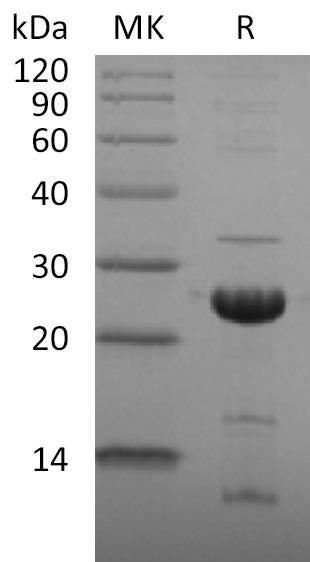 Recombinant 2019-nCoV NSP1 Protein (His Tag)