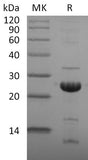 Recombinant 2019-nCoV NSP1 Protein (His Tag)