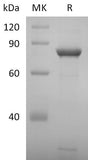 Recombinant 2019-nCoV NSP2 Protein (His Tag)