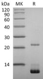 Recombinant 2019-nCoV NSP7 Protein (His Tag)