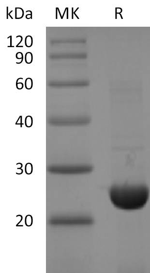 Recombinant 2019-nCoV NSP8 Protein (His Tag)
