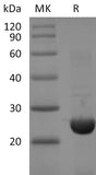 Recombinant 2019-nCoV NSP8 Protein (His Tag)