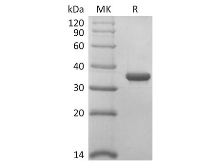 Recombinant 2019-nCoV Papain-Like Protease Protein