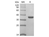 Recombinant 2019-nCoV Papain-Like Protease Protein