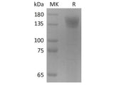 Recombinant 2019-nCoV S1 Protein (Fc Tag) Store at < -20°C