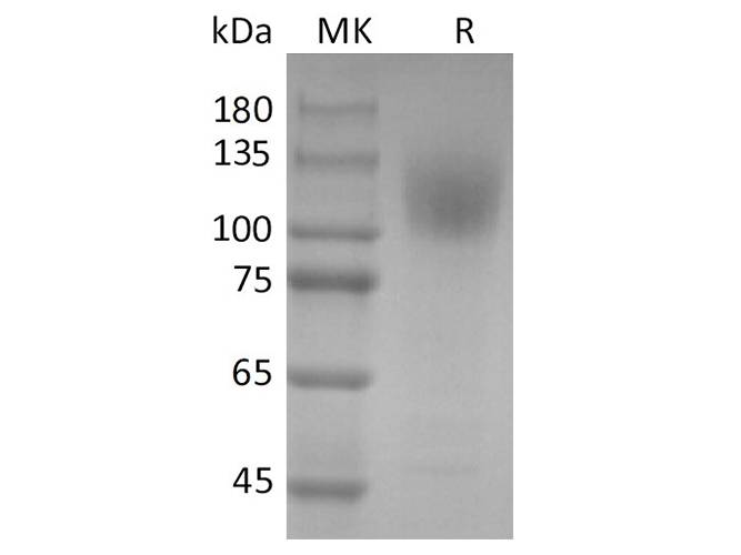 Recombinant 2019-nCoV S1 Protein (His Tag) Store at < -20°C