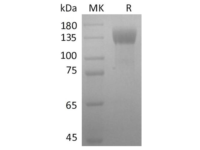 Recombinant 2019-nCoV S1 Protein (mFc Tag) Store at < -20°C