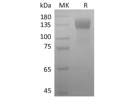Recombinant 2019-nCoV S1 Protein (mFc Tag) Store at < -20°C