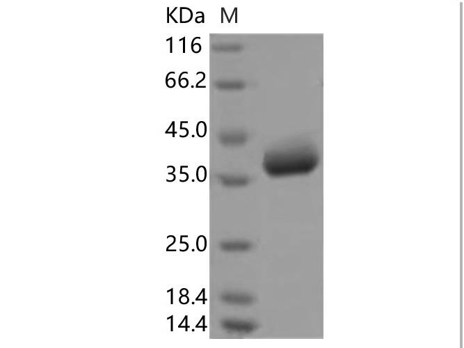 Recombinant 2019-nCoV Spike Protein, Biotinylated  (RBD, Avi-His Tag)(Active)