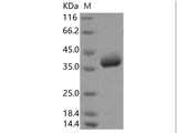 Recombinant 2019-nCoV Spike Protein, Biotinylated  (RBD, Avi-His Tag)(Active)