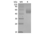 Recombinant 2019-nCoV Spike Protein (NTD, His Tag)