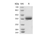 Recombinant 2019-nCoV Spike Protein (RBD, His Tag)