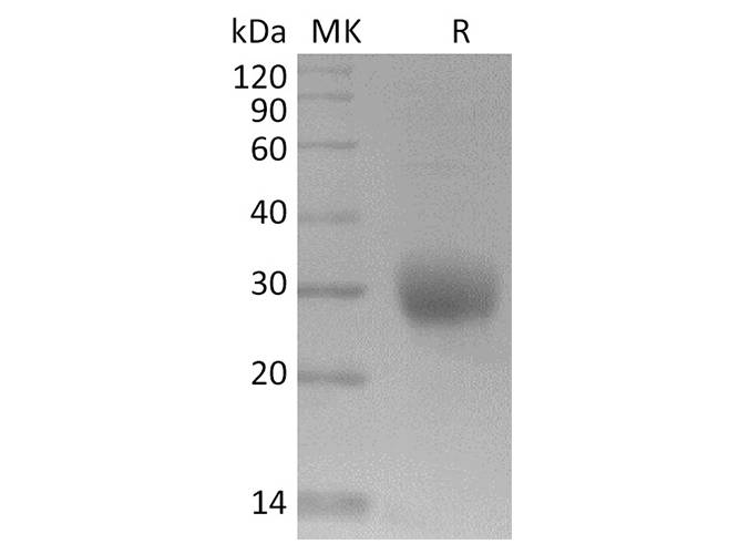 Recombinant 2019-nCoV Spike Protein (RBD, His Tag) Store at < -20°C