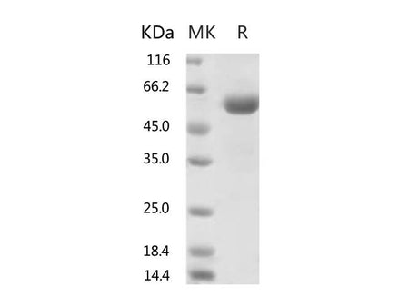 Recombinant 2019-nCoV Spike Protein (RBD, mFc Tag)(V367F)