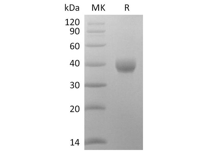 Recombinant 2019-nCoV Spike Protein (RBD-SD1, His Tag)