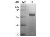 Recombinant 2019-nCoV Spike Protein (RBD-SD1, mFc Tag)