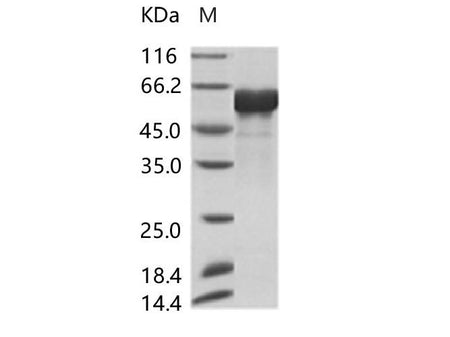 Recombinant AcmNPV Envelope glycoprotein gp64(His Tag)