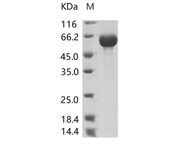 Recombinant AcmNPV Envelope glycoprotein gp64(His Tag)